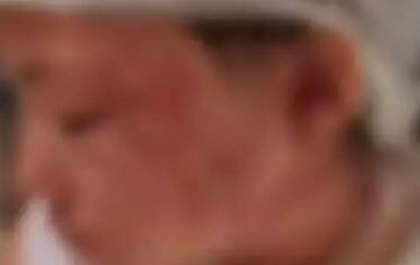 Menina de 14 anos morre na Santa Casa de MS, após sofrer queimaduras graves fazendo bife na chapa
