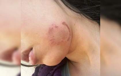 Homem terá que pagar R$ 15 mil para a ex-esposa por agredi-la