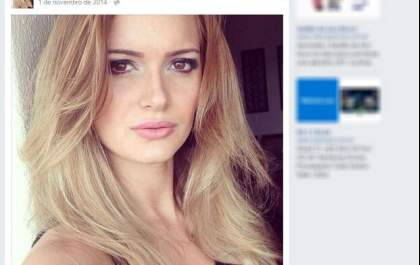 Mulher fratura coluna em treino na academia