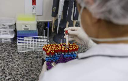 Laboratório de análises clínicas da Cassems é referência em credibilidade e segurança na obtenção de resultados