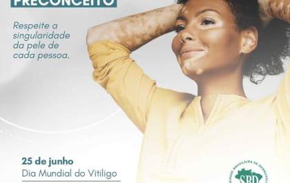 Dia Mundial do Vitiligo