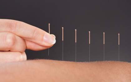 A Acupuntura e a arte milenar de equilibrar o ser humano