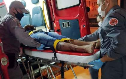 Casal em moto ferido em acidente na Av. Guanabara