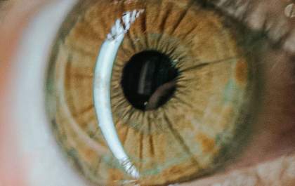 Iridologia: Você sabia que pode ser diagnosticado através da íris ocular?