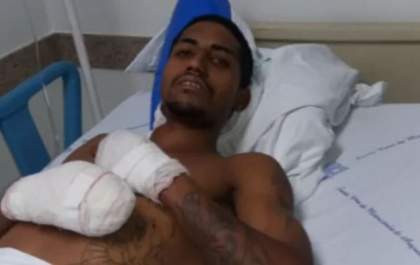 Ciclista amputado em Araçatuba pede ajuda para custos médicos