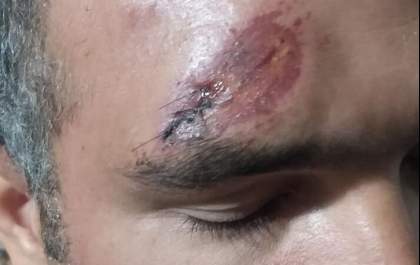 Acusado de atropelar policial em Bilac é preso