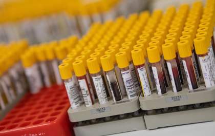 Covid-19: país acumula 20,9 milhões de casos e 586 mil óbitos