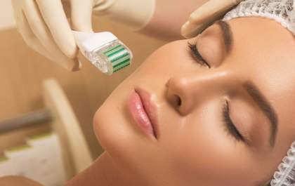 Microagulhamento: o método eficaz para tratar cicatrizes e marcas de acne