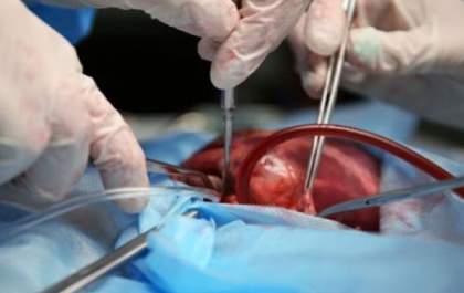 Brasileiros estudam transplante de rim suíno em humanos