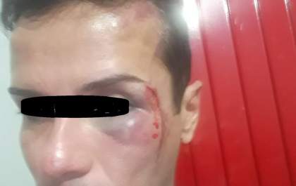 Travesti é acusada de furto e agredida em TL