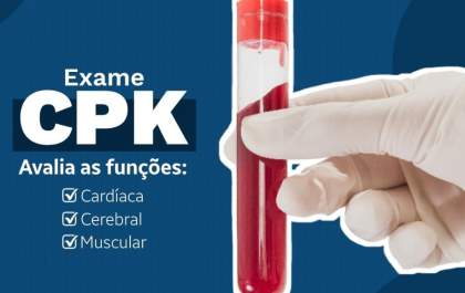 Conheça o exame de CPK, aliado na identificação de doenças cardíacas, cerebrais e musculares