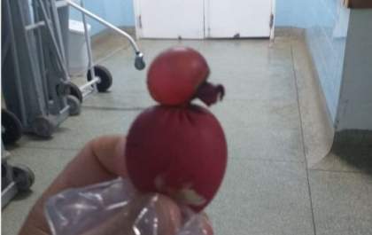 Após ser ameaçado por aluno, jovem com deficiência intelectual é obrigado a engolir bexiga com água