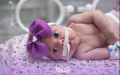 Ensaio fotográfico humaniza situação de bebês prematuros