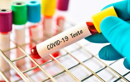 Planos de Saúde não podem se recusar a fazer teste de covid