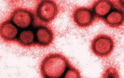 MS tem 193 casos e 15 mortes provocadas por Influenza A H3N2