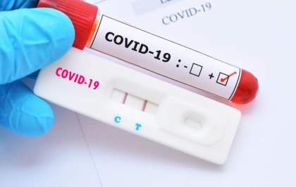 Procon-SP irá fiscalizar preços de testes de covid-19