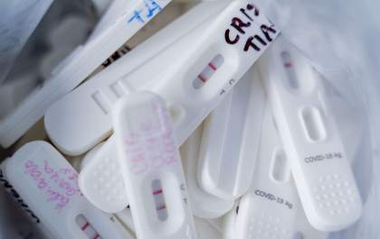 Procon-SP fiscaliza preços abusivos de testes de covid-19
