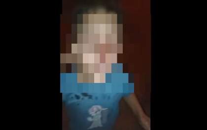 Menino de 10 anos é brutalmente agredido pela madrasta e fica com rosto deformado