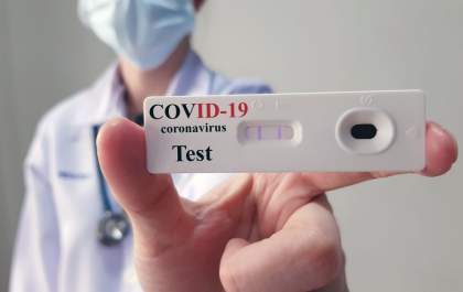 Procon notifica farmácias sobre falta de testes de covid-19