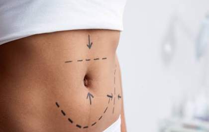 Você quer fazer plástica, mas tem medo? Médico esclarece principais dúvidas sobre cirurgias