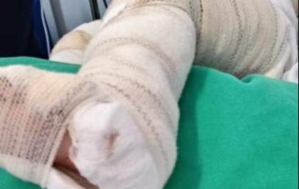 Idoso de 78 anos, morador de asilo, morre após queimadura durante banho