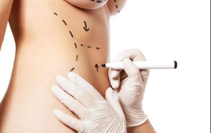 Abdominoplastia: saiba tudo sobre uma das cirurgias mais realizadas no Brasil
