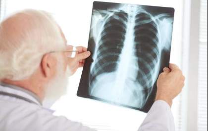 Saúde intensifica busca ativa de tuberculose em Birigui