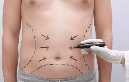 Cirurgia plástica ganha força também entre os homens&nbsp;