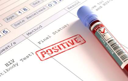 Com nova variante, mais transmissível e agressiva, especialistas alertam para importância do diagnóstico precoce do HIV
