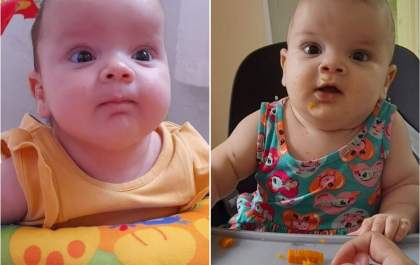 Bebê que passou por cirurgia no crânio com ajuda de 'vaquinha' se recupera bem