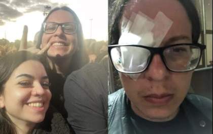 Perigo: Fã sofre grave ferimento em olho durante show do Metallica