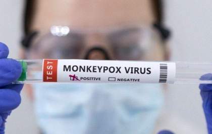 Brasil vive ameaça de varíola do macaco ainda sem protocolo e insumos para testar casos suspeitos
