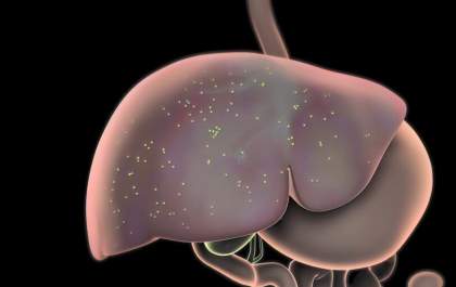 Hepatite misteriosa: 9 sinais de alerta para os pais