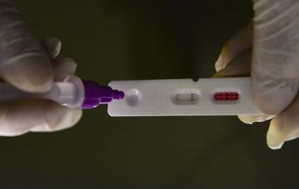 Pesquisadores identificam método capaz de prever gravidade da covid-19