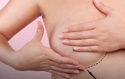 Saiba quais são as 5 cirurgias plásticas mais procuradas na clínica All Life