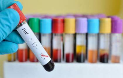 Prevalência de HIV dobra em 20 anos no Brasil, aponta relatório de programa das Nações Unidas