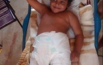 Com doença rara, menina de 12 anos precisa de ajuda para tratamento