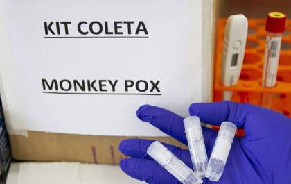 Brasil se torna o terceiro país do mundo em número de casos de varíola do macaco