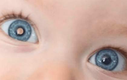 Hospital do Olho faz ação de prevenção ao retinoblastoma neste sábado