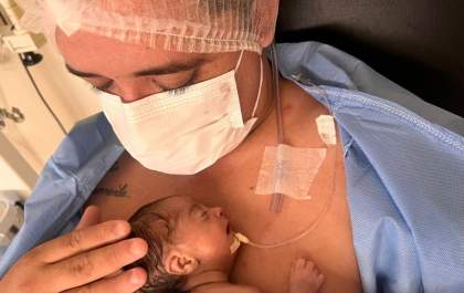Hospital Auxiliadora realiza Método Canguru de atenção humanizada em bebê recém-nascido
