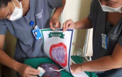 Projeto Árvore da Vida da Santa Casa de Birigui eterniza a emoção do parto