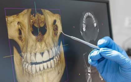 Raio X com segurança e precisão na DVI Radiologia Odontológica