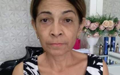 Com câncer raro, mulher precisa de ajuda para arcar com remédio de R$ 15 mil