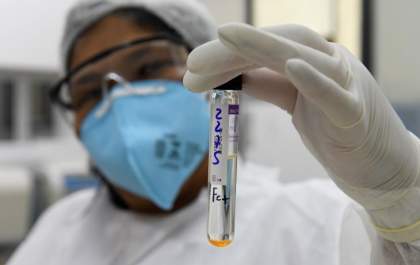 Com prática inovadora, Lacen passará a fazer sequenciamento genômico da turberculose no Estado