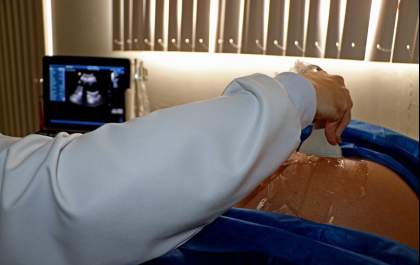 USFs passam a oferecer exame de Ultrassom Obstétrico para fase inicial do pré-natal