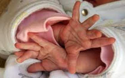 &nbsp;Bebê de 2 meses morre sufocado
