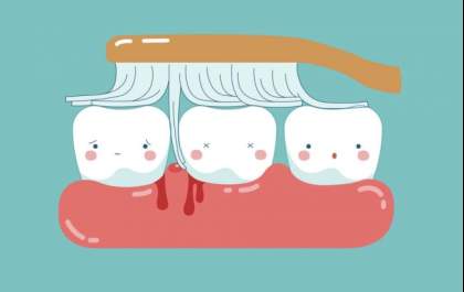 Sangramento ao escovar os dentes pode ser gengivite, alerta dentistas da OdontoX&nbsp;