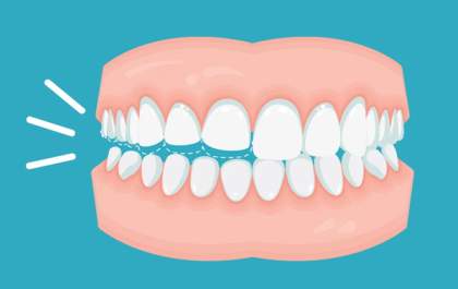 É possível sofrer com bruxismo durante o dia? Dentistas da OdontoX esclarecem