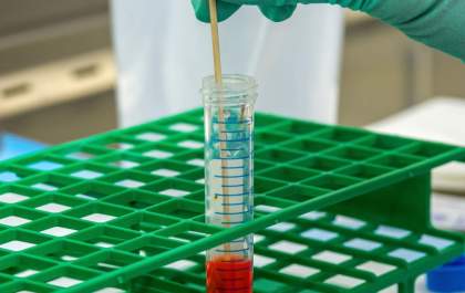 Alerta para o diagnóstico precoce de anemia e leucemia, doenças ligadas ao sangue