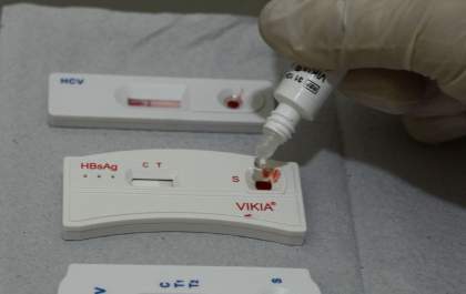 SP tem 30 mil cadastrados para profilaxia pré-exposição ao HIV